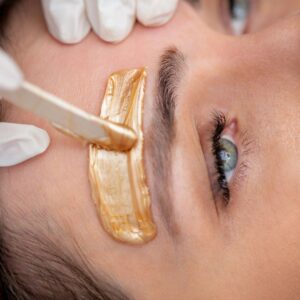 Surgical Removal